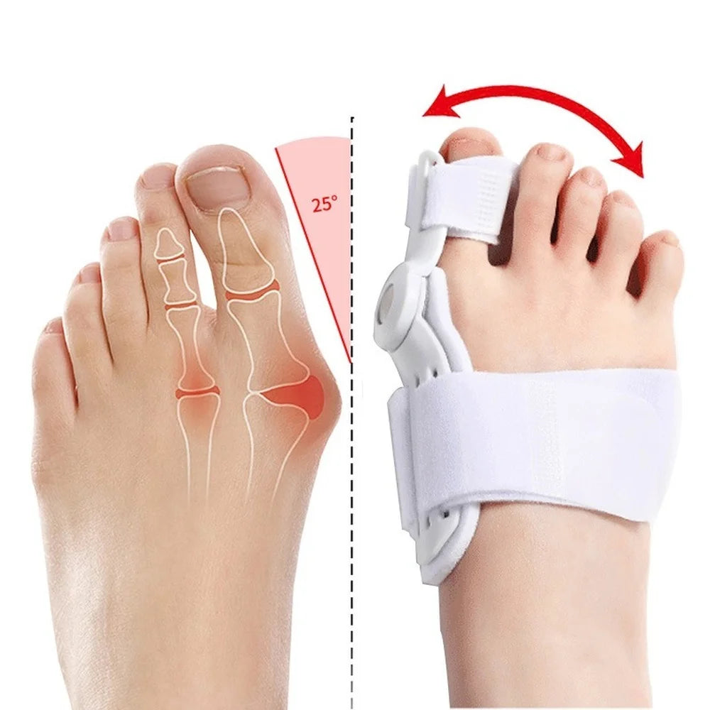 Corrector de férula para juanete, Corrector para aliviar el dolor en el pie, Hallux Valgus, Protector para el cuidado de los pies, 1 unidad/2 uds. 