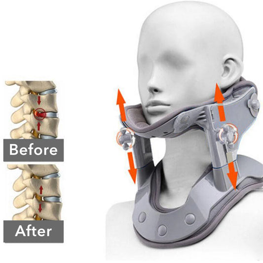 Dispositivo de tracción de cuello médico, kit de corrección de cuello Cervical inflable, Retractor de cuello, camilla de cuello Cervical, alivio del dolor de columna